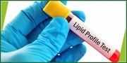Lipid Profile Test in Jaipur