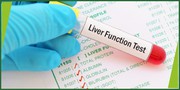 Liver Function Test in Jaipur