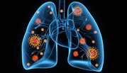 Enhancing Lung Capacity Naturally